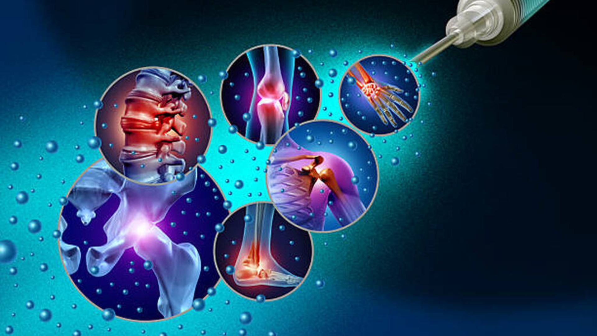 regenerative medicine Medellin for international patients