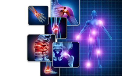 Joint Pain Therapy Medellin Regenerative Solutions