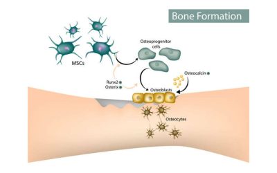 Stem Cell Therapy Medellin Colombia Regenerative Medicine