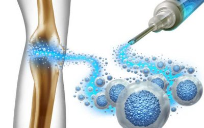 Stem Cell Therapy Medellin for Regenerative Care