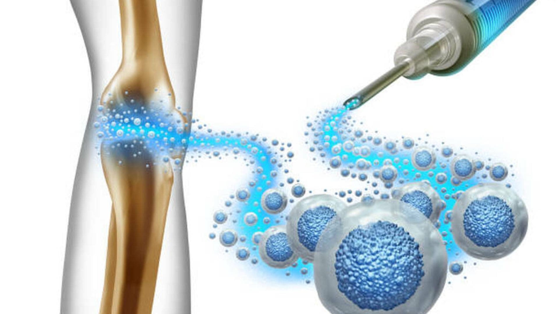 Stem Cell Therapy Medellin for Regenerative Care