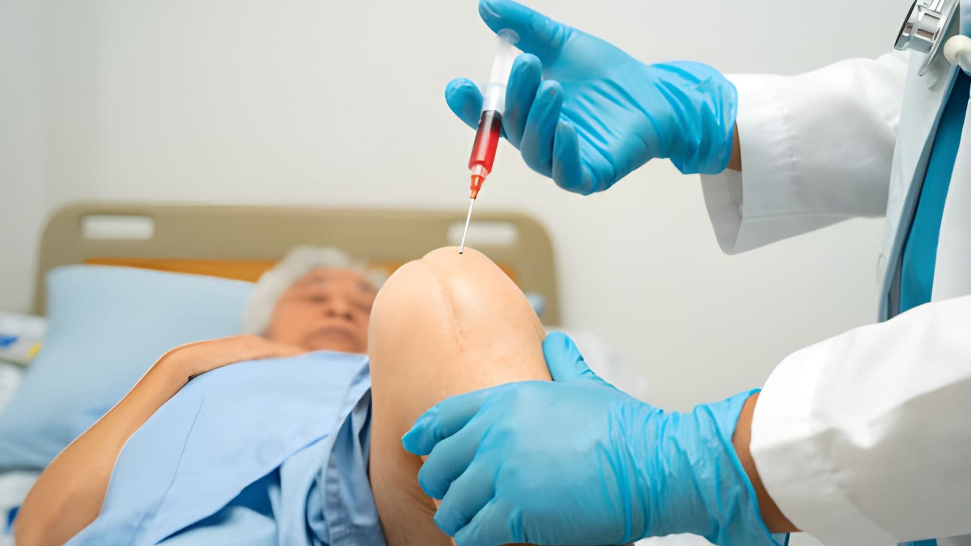 Colombia Stem Cell Treatment for Non-Surgical Recovery Colombia Stem Cell Treatment for Non-Surgical Recovery
