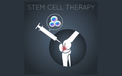 Stem Cell Therapy for Chronic Joint Pain Medellin