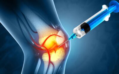 Stem Cell Therapy for Knee Pain in Colombia