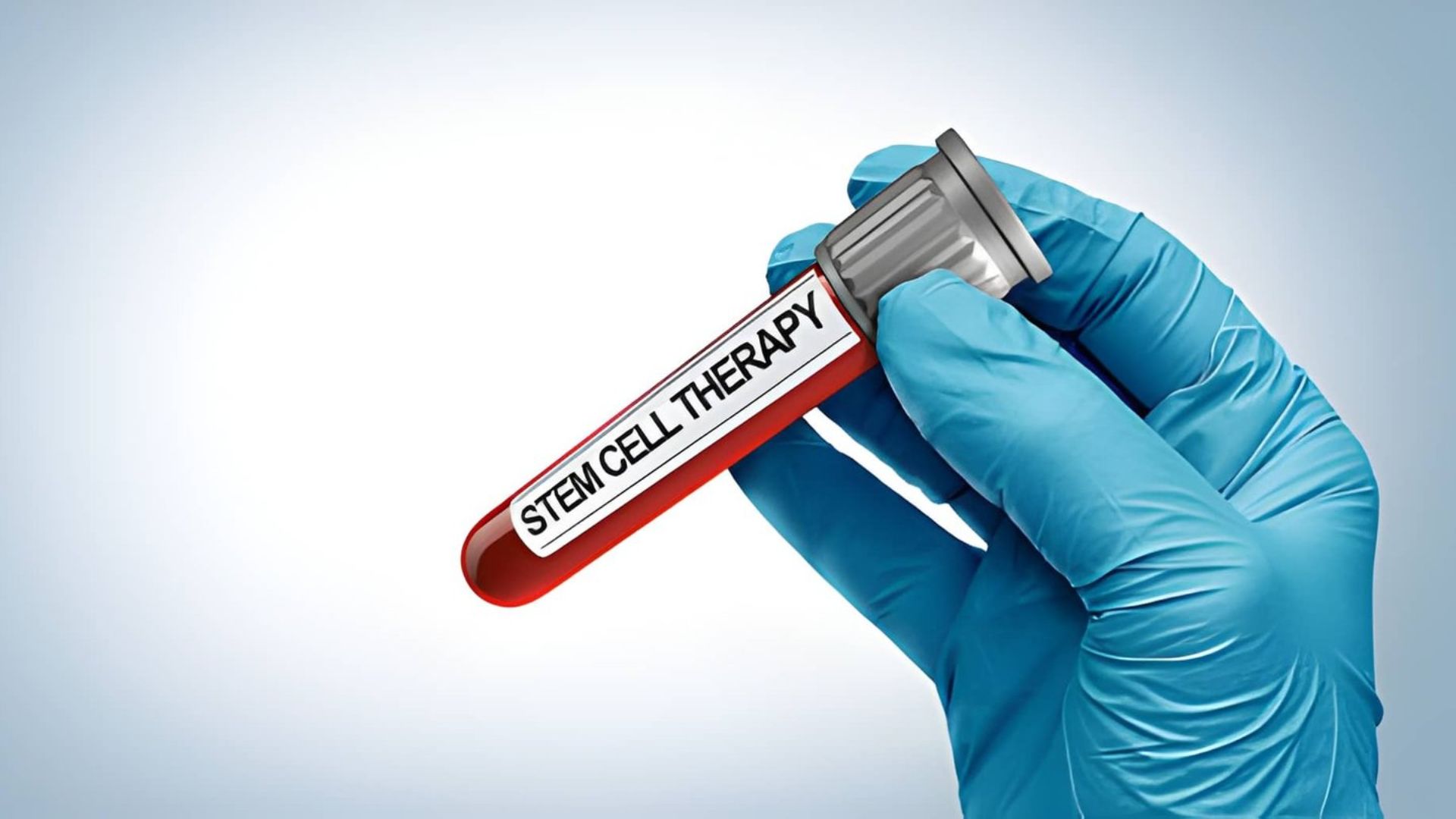 Stem Cell Treatment Near Me Understanding Modern Regenerative Therapy Options