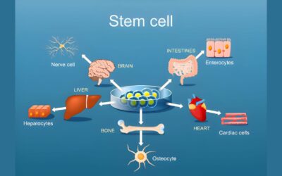 How Stem Cell Therapy Is Advancing Treatment for Parkinson’s Disease