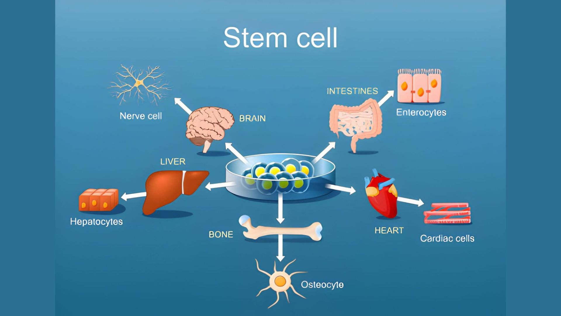 How Stem Cell Therapy Is Advancing Treatment for Parkinson’s Disease