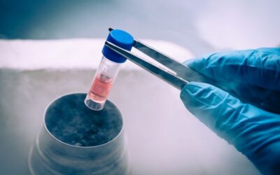 Mesenchymal Stem Cell Therapy: What It Is and How It Is Studied