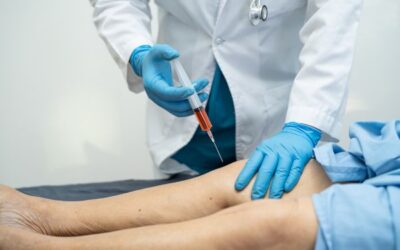 Comparing Stem Cell Therapy and Surgery for Joint Pain