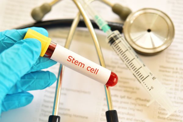 Stem Cell Therapy Risks Medellin Patients Should Consider
