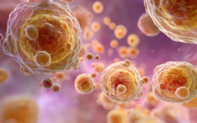 What to Expect During Stem Cell Treatment and Recovery