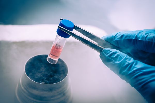 Who Is Not a Candidate for Stem Cell Therapy Who Is Not a Candidate for Stem Cell Therapy?