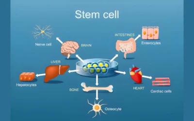 How Stem Cell Therapy Is Advancing Treatment for Parkinson’s Disease
